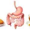 Ten worst foods for acid reflux with stomach illustration showing trigger foods and healthy alternatives